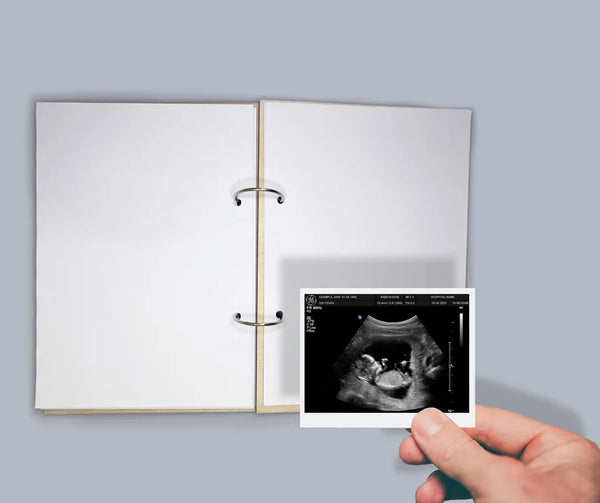 We can't wait to meet you - Pregnancy Journal Wooden Baby Scan Scrapbook